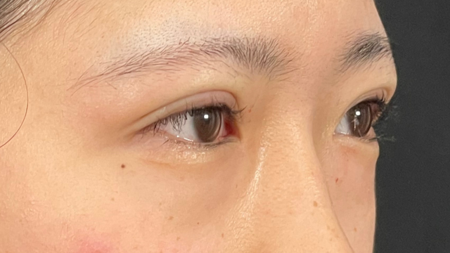 Postoperative Condition Part 1