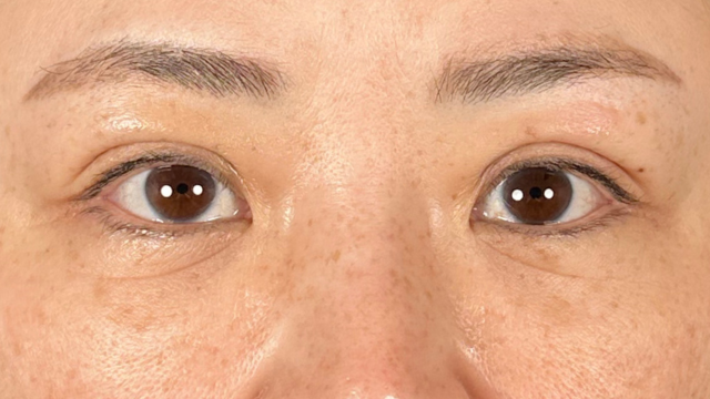 Postoperative Condition Part 1