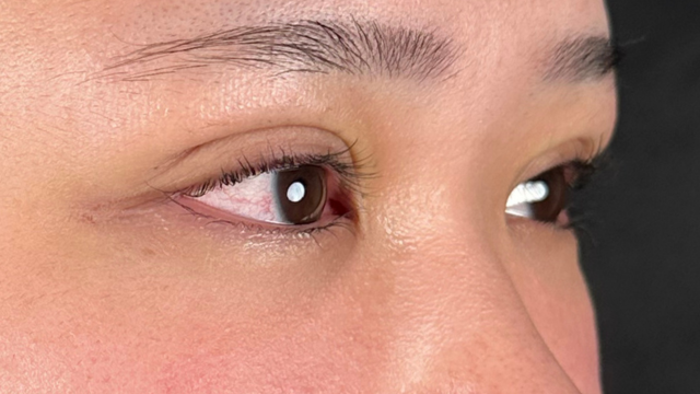 Postoperative Condition Part 1