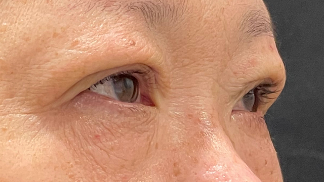 Postoperative Condition Part 1