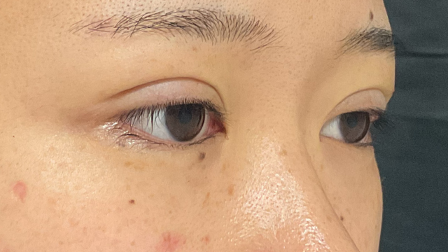 Postoperative Condition Part 1