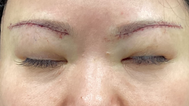 Postoperative Condition Part 1