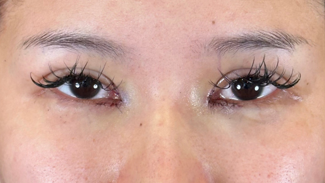 Postoperative Condition Part 1