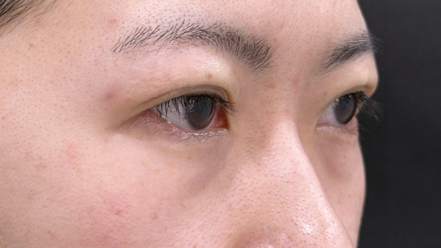 Postoperative Condition Part 1