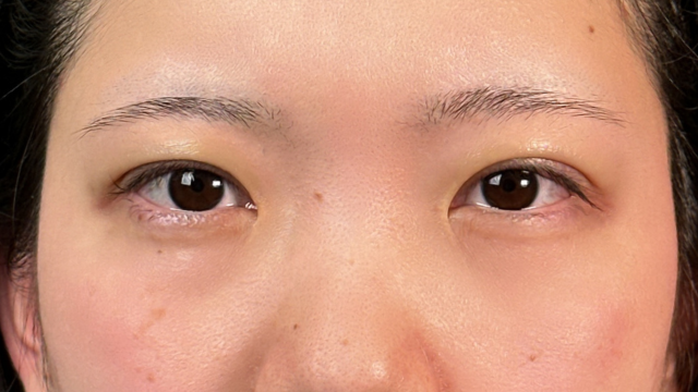 Postoperative Condition Part 1