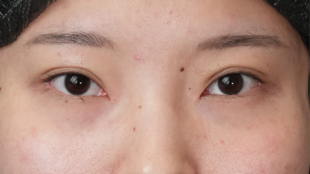 Postoperative Condition Part 1