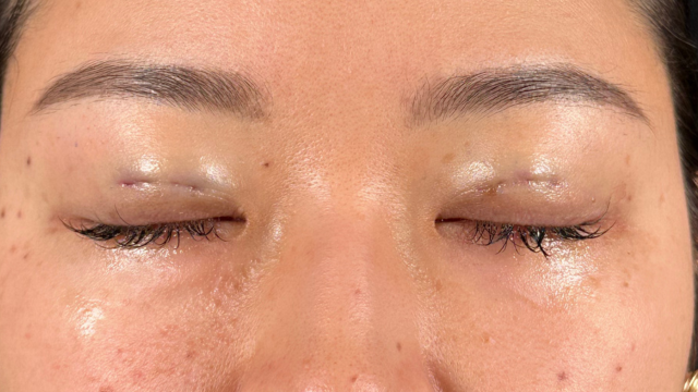 Postoperative Condition Part 1