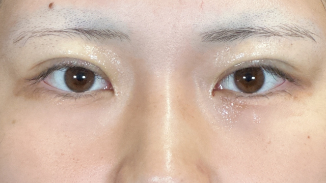 Postoperative Condition Part 1