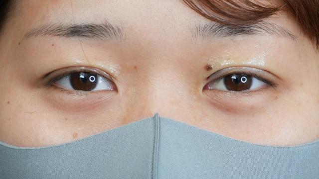 Postoperative Condition Part 1