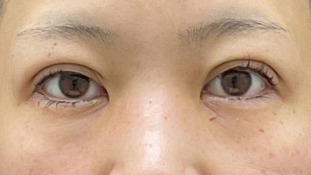 Postoperative Condition Part 1