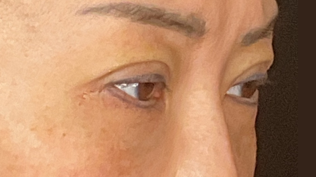 Postoperative Condition Part 1