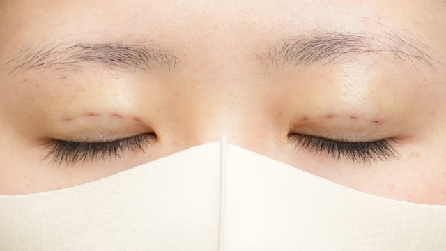 Postoperative Condition Part 1