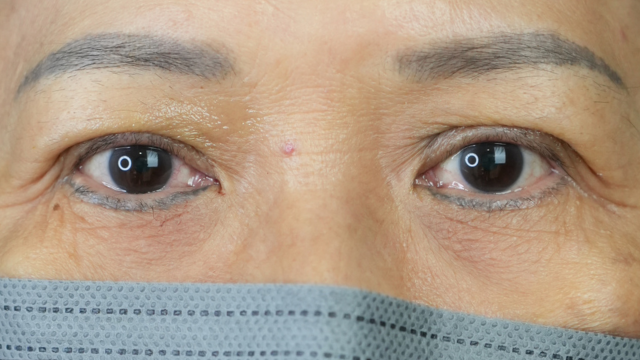 Postoperative Condition Part 1