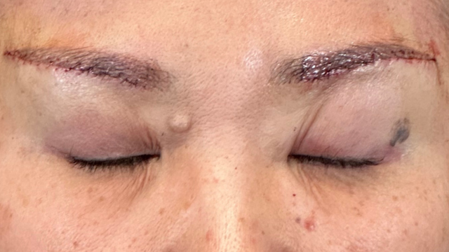 Postoperative Condition Part 1