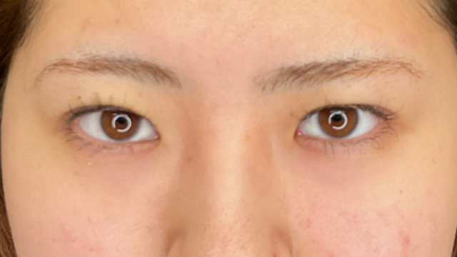 Postoperative Condition Part 1