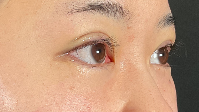 Postoperative Condition Part 1