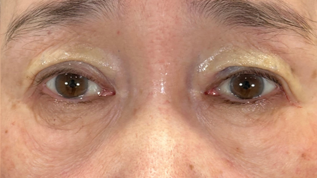 Postoperative Condition Part 1