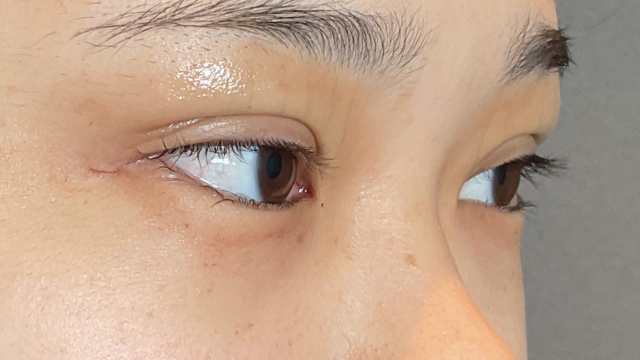 Postoperative Condition Part 1