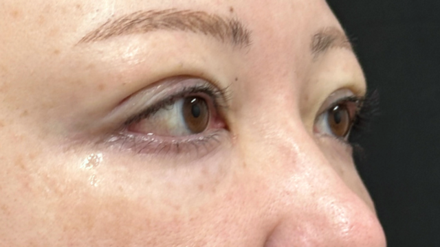 Postoperative Condition Part 1