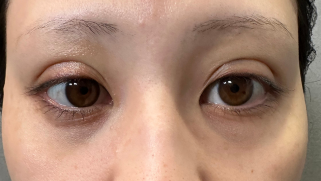 Postoperative Condition Part 1