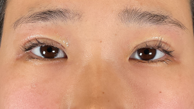 Postoperative Condition Part 1