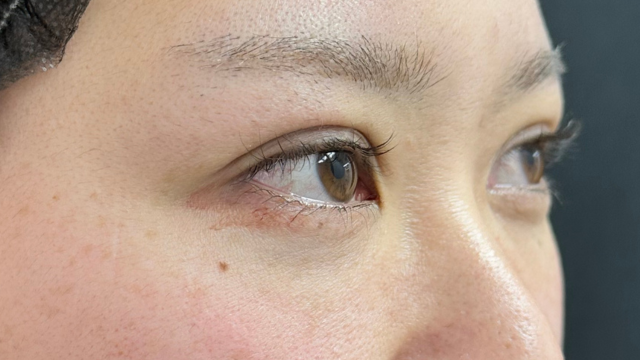 Postoperative Condition Part 1