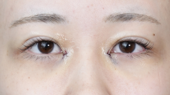 Postoperative Condition Part 1