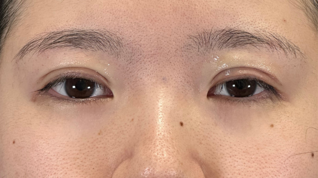 Postoperative Condition Part 1