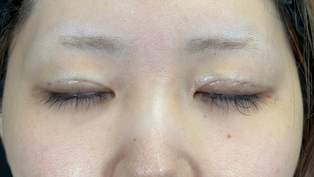 Postoperative Condition Part 1