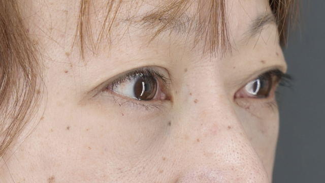 Postoperative Condition Part 1