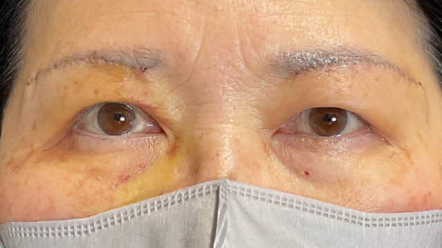 Postoperative Condition Part 1