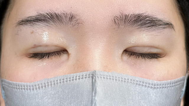 Postoperative Condition Part 1