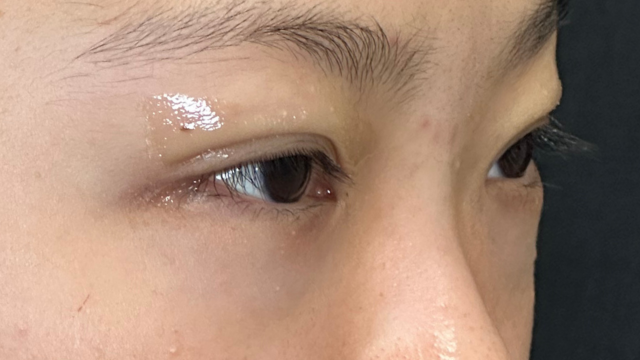 Postoperative Condition Part 1