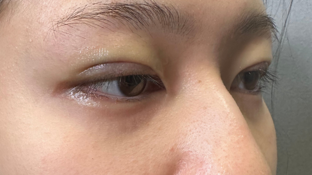 Postoperative Condition Part 1