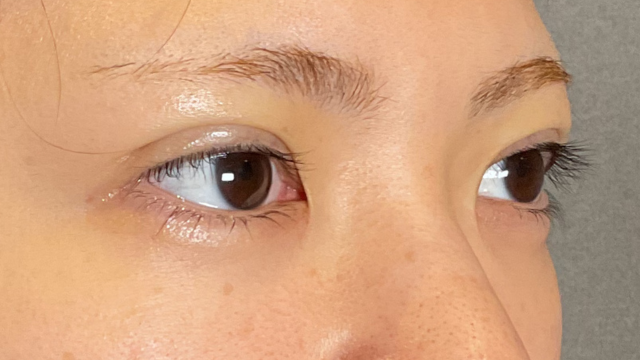 Postoperative Condition Part 1