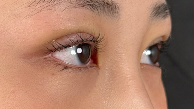 Postoperative Condition Part 1