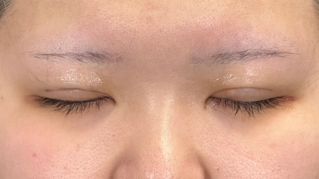 Postoperative Condition Part 1