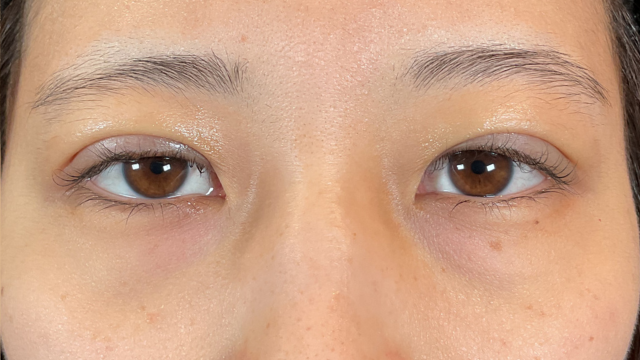 Postoperative Condition Part 1