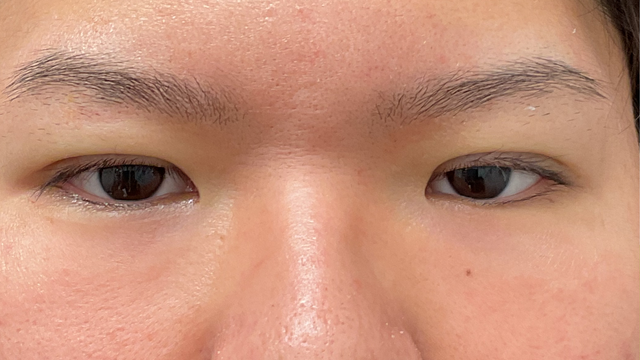 Postoperative Condition Part 1