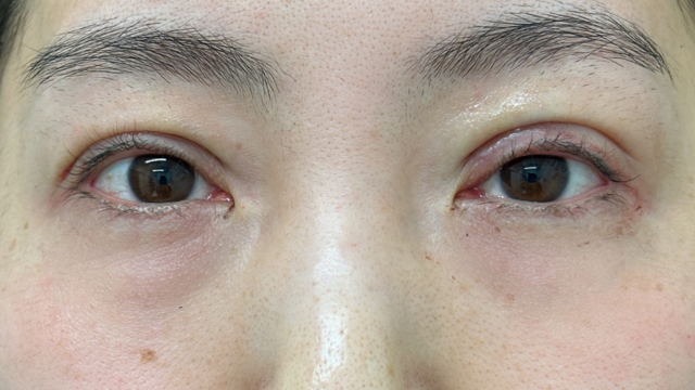 Postoperative Condition Part 1