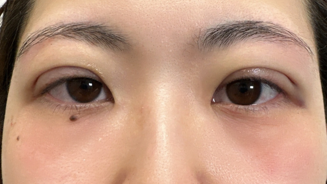 Postoperative Condition Part 1