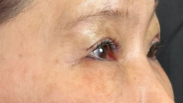 Postoperative Condition Part 1