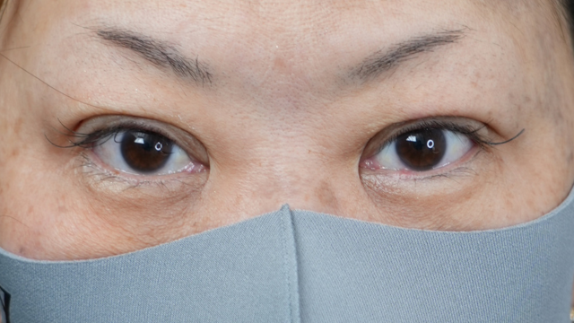 Postoperative Condition Part 1