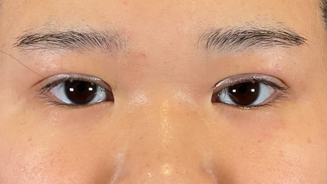 Postoperative Condition Part 1