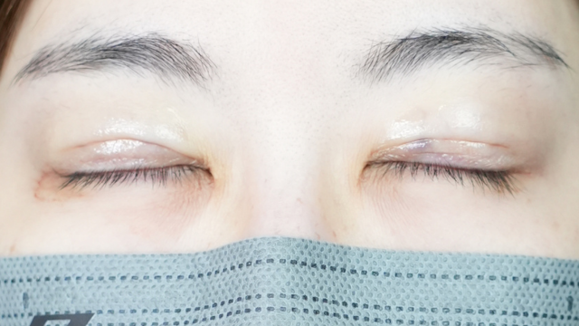 Postoperative Condition Part 1