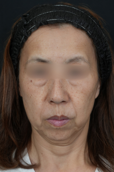 Postoperative Condition Part 1