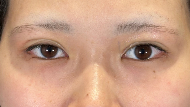 Postoperative Condition Part 1