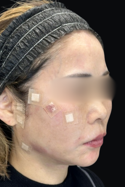 Postoperative Condition Part 1