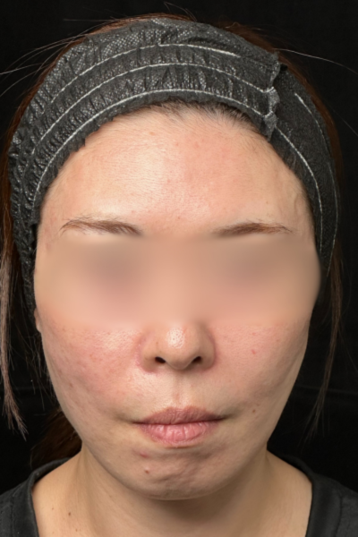 Postoperative Condition Part 1