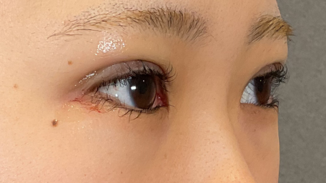 Postoperative Condition Part 1